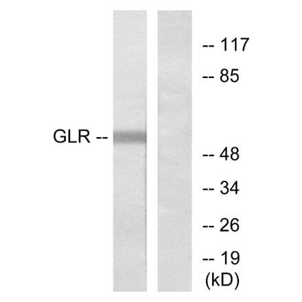 Western Blot - Anti-GLR Antibody (G275) - Antibodies.com