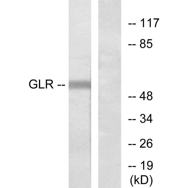 Western Blot - Anti-GLR Antibody (G275) - Antibodies.com