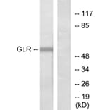 Western Blot - Anti-GLR Antibody (G275) - Antibodies.com