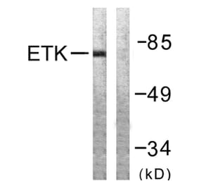 Western Blot - Anti-ETK Antibody (B0787) - Antibodies.com