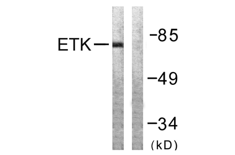 Western Blot - Anti-ETK Antibody (B0787) - Antibodies.com