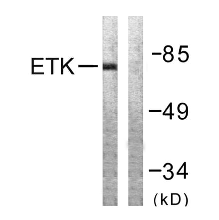 Western Blot - Anti-ETK Antibody (B0787) - Antibodies.com