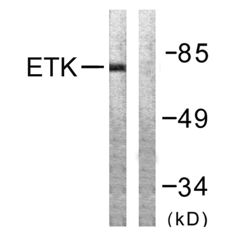 Western Blot - Anti-ETK Antibody (B0787) - Antibodies.com