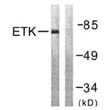 Western Blot - Anti-ETK Antibody (B0787) - Antibodies.com