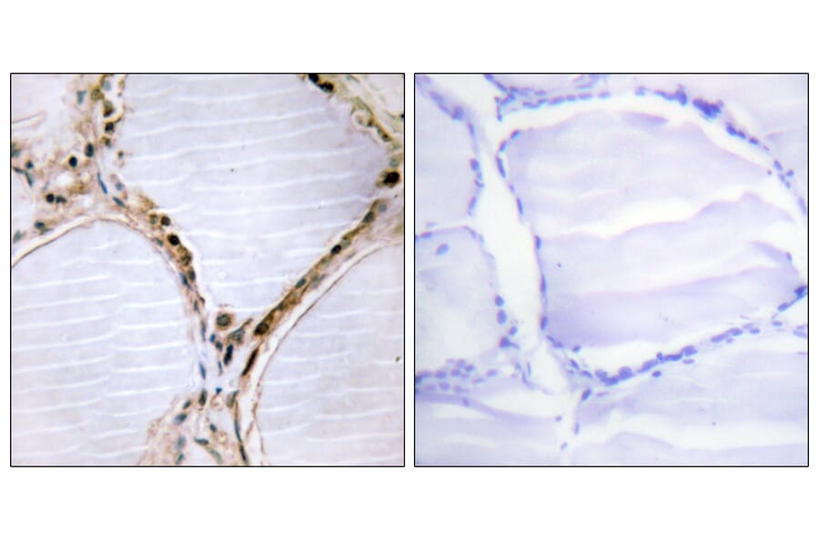 Immunohistochemistry - Anti-ETK Antibody (B0787) - Antibodies.com