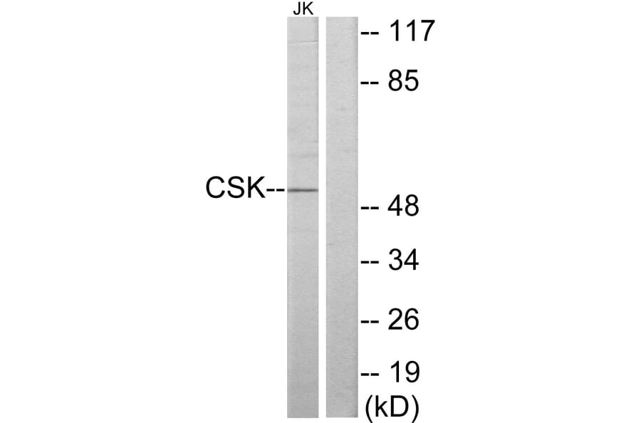Western Blot - Anti-CSK Antibody (C10598) - Antibodies.com