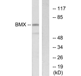 Western Blot - Anti-BMX Antibody (C10688) - Antibodies.com