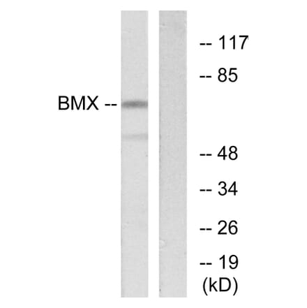 Western Blot - Anti-BMX Antibody (C10688) - Antibodies.com