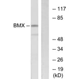 Western Blot - Anti-BMX Antibody (C10688) - Antibodies.com