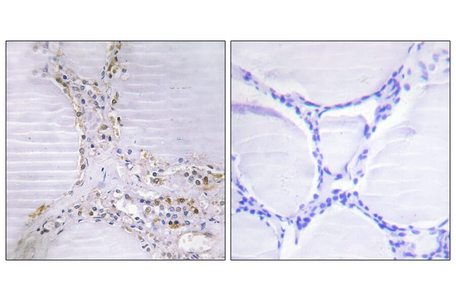 Immunohistochemistry - Anti-BMX Antibody (C10688) - Antibodies.com