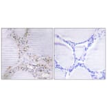 Immunohistochemistry - Anti-BMX Antibody (C10688) - Antibodies.com