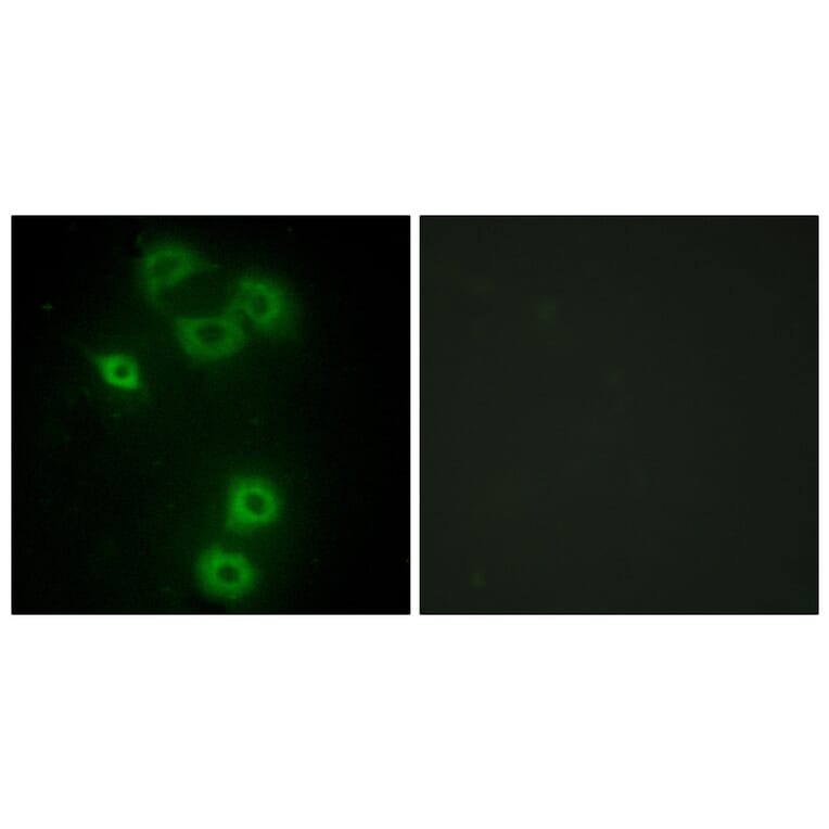 Immunofluorescence - Anti-BMX Antibody (C10688) - Antibodies.com