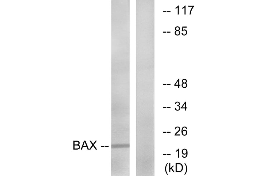 Western Blot - Anti-Bax Antibody (B0773) - Antibodies.com