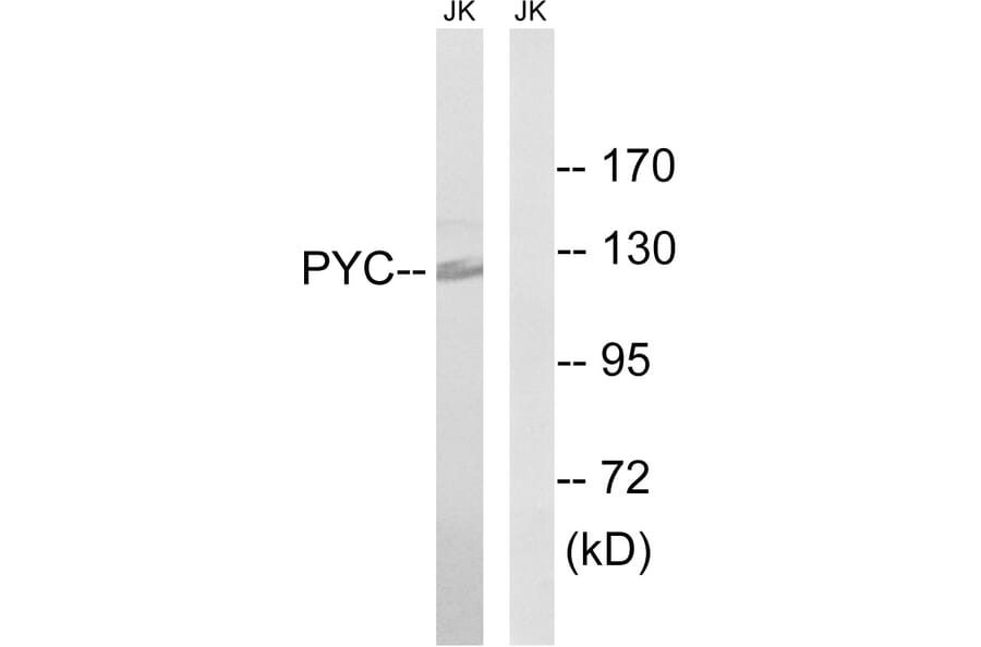 Western Blot - Anti-PC Antibody (C18099) - Antibodies.com