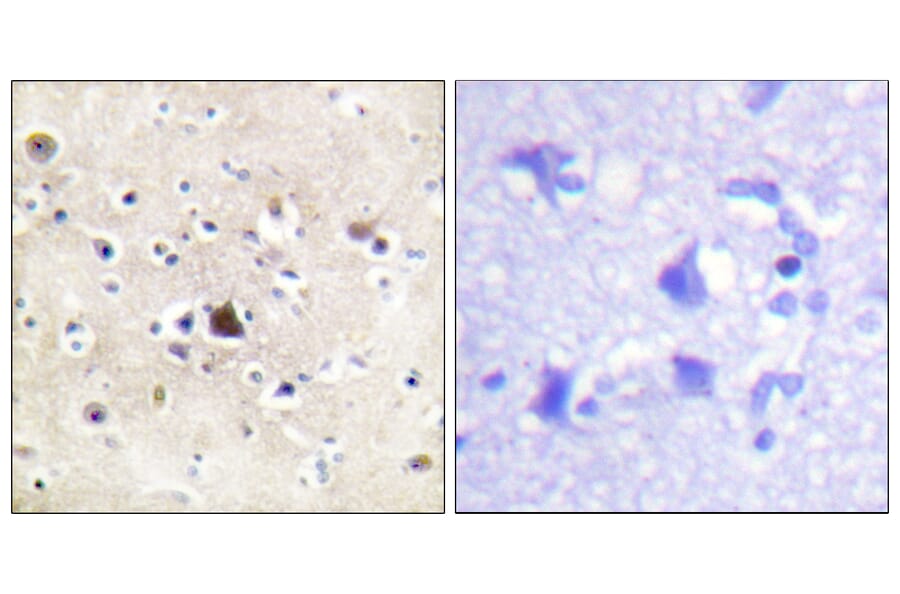 Immunohistochemistry - Anti-GR Antibody (B0432) - Antibodies.com