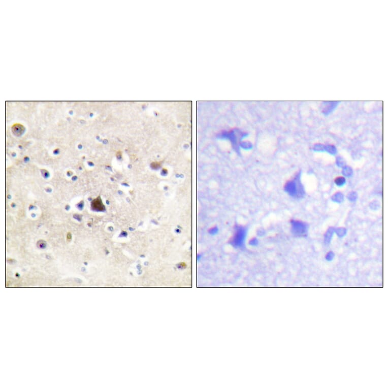 Immunohistochemistry - Anti-GR Antibody (B0432) - Antibodies.com