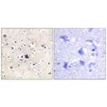 Immunohistochemistry - Anti-GR Antibody (B0432) - Antibodies.com
