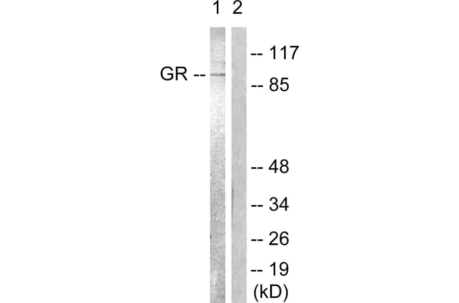 Western Blot - Anti-GR Antibody (B0432) - Antibodies.com