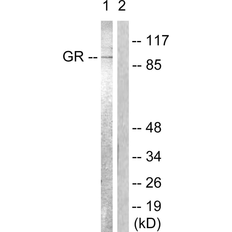 Western Blot - Anti-GR Antibody (B0432) - Antibodies.com