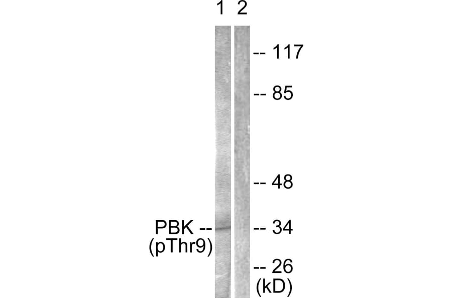 Western Blot - Anti-PBK (phospho Thr9) Antibody (A0710) - Antibodies.com