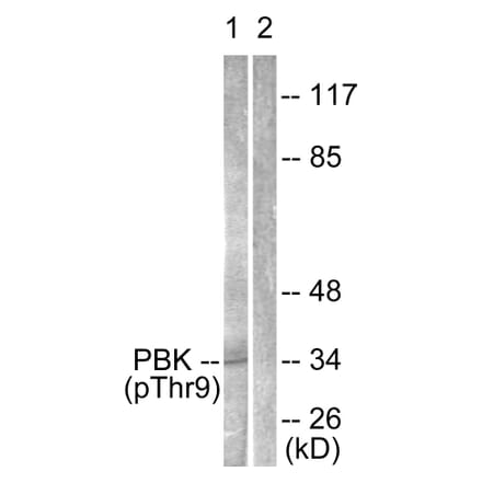 Western Blot - Anti-PBK (phospho Thr9) Antibody (A0710) - Antibodies.com