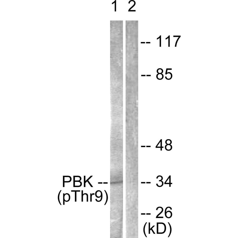 Western Blot - Anti-PBK (phospho Thr9) Antibody (A0710) - Antibodies.com