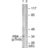 Western Blot - Anti-PBK (phospho Thr9) Antibody (A0710) - Antibodies.com