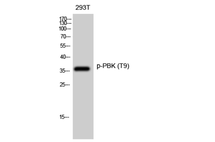 Western Blot - Anti-PBK (phospho Thr9) Antibody (A0710) - Antibodies.com