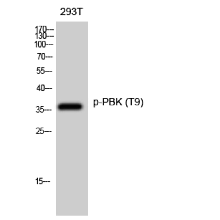 Western Blot - Anti-PBK (phospho Thr9) Antibody (A0710) - Antibodies.com