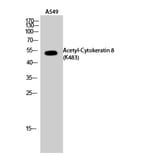 Western Blot - Anti-K8 (acetyl Lys483) Antibody (D12135) - Antibodies.com