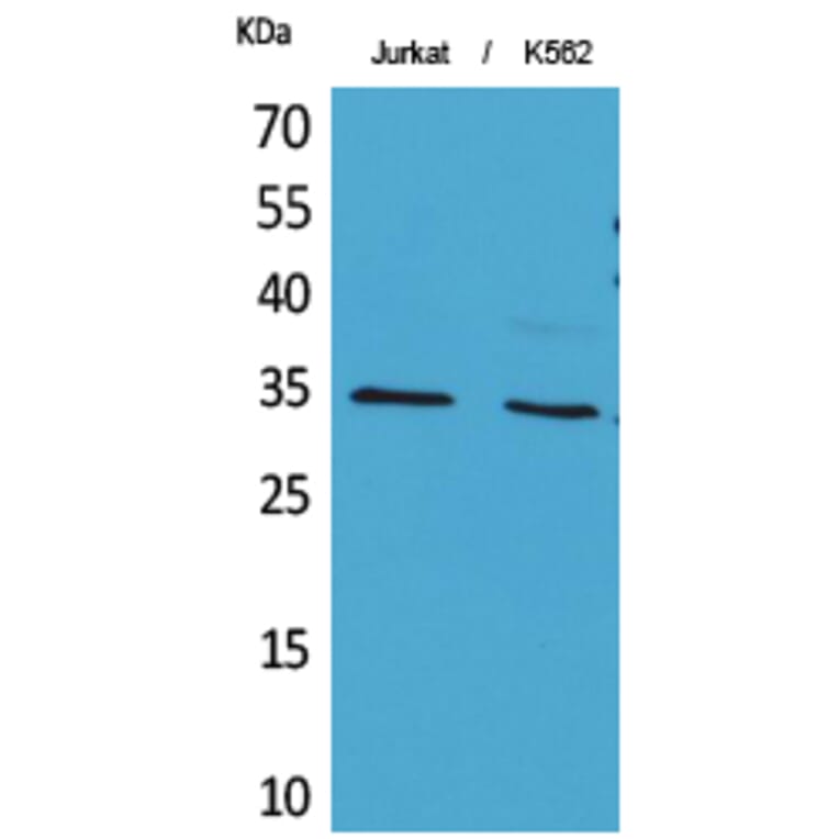 Western Blot - Anti-APE1 (acetyl Lys7) Antibody (D12045) - Antibodies.com