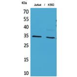 Western Blot - Anti-APE1 (acetyl Lys7) Antibody (D12045) - Antibodies.com