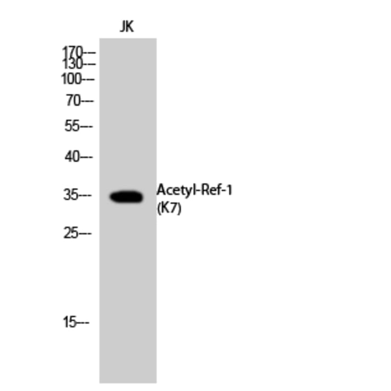 Western Blot - Anti-APE1 (acetyl Lys7) Antibody (D12045) - Antibodies.com