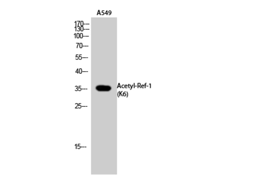 Western Blot - Anti-APE1 (acetyl Lys6) Antibody (D12044) - Antibodies.com