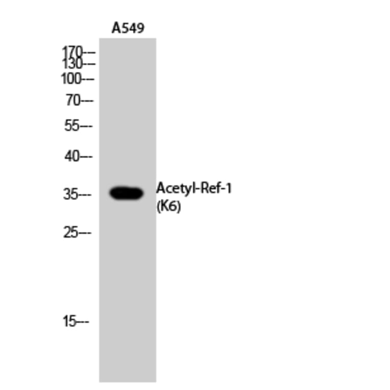 Western Blot - Anti-APE1 (acetyl Lys6) Antibody (D12044) - Antibodies.com