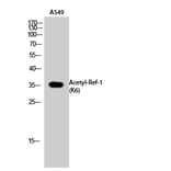 Western Blot - Anti-APE1 (acetyl Lys6) Antibody (D12044) - Antibodies.com