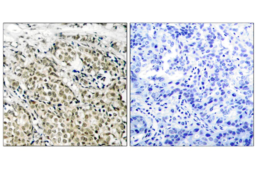 Immunohistochemistry - Anti-Androgen Receptor Antibody (B7008) - Antibodies.com