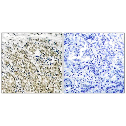 Immunohistochemistry - Anti-Androgen Receptor Antibody (B7008) - Antibodies.com