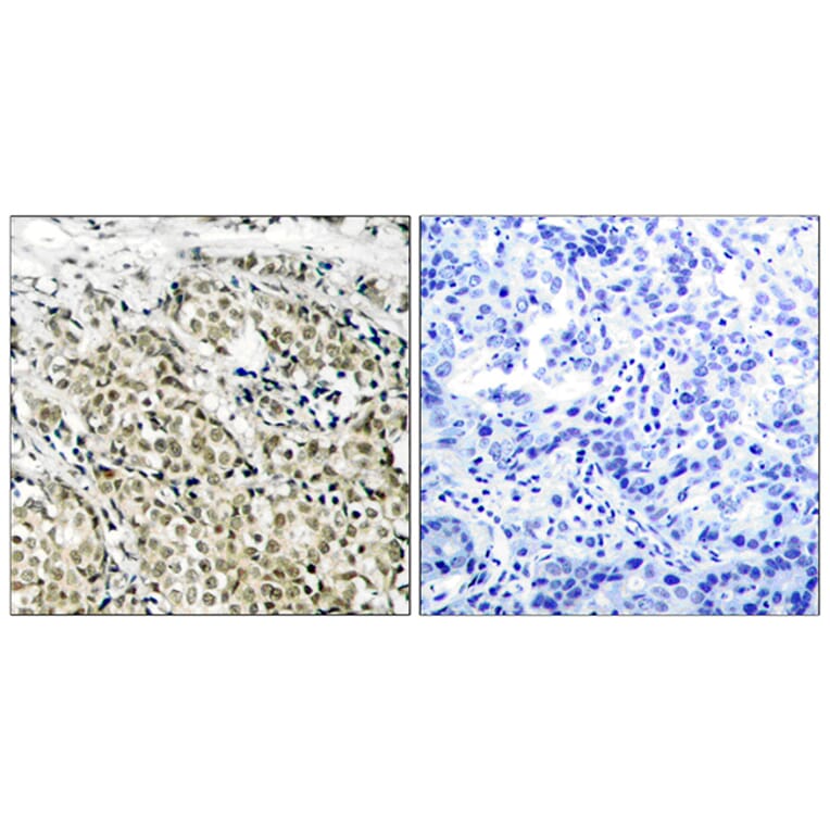 Immunohistochemistry - Anti-Androgen Receptor Antibody (B7008) - Antibodies.com