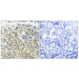 Immunohistochemistry - Anti-Androgen Receptor Antibody (B7008) - Antibodies.com