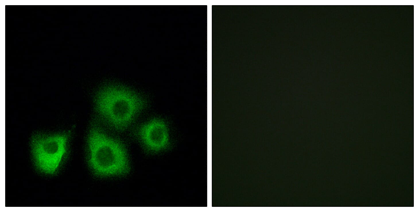 Immunofluorescence analysis of MCF7 cells using Anti-OR5M1 + OR5M10 Antibody. The right hand panel represents a negative control, where the antibody was pre-incubated with the immunising peptide.