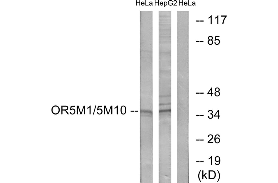 Western Blot - Anti-OR5M1 + OR5M10 Antibody (G915) - Antibodies.com