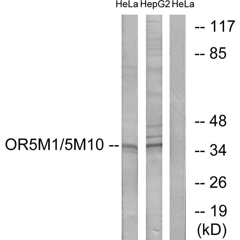 Western Blot - Anti-OR5M1 + OR5M10 Antibody (G915) - Antibodies.com