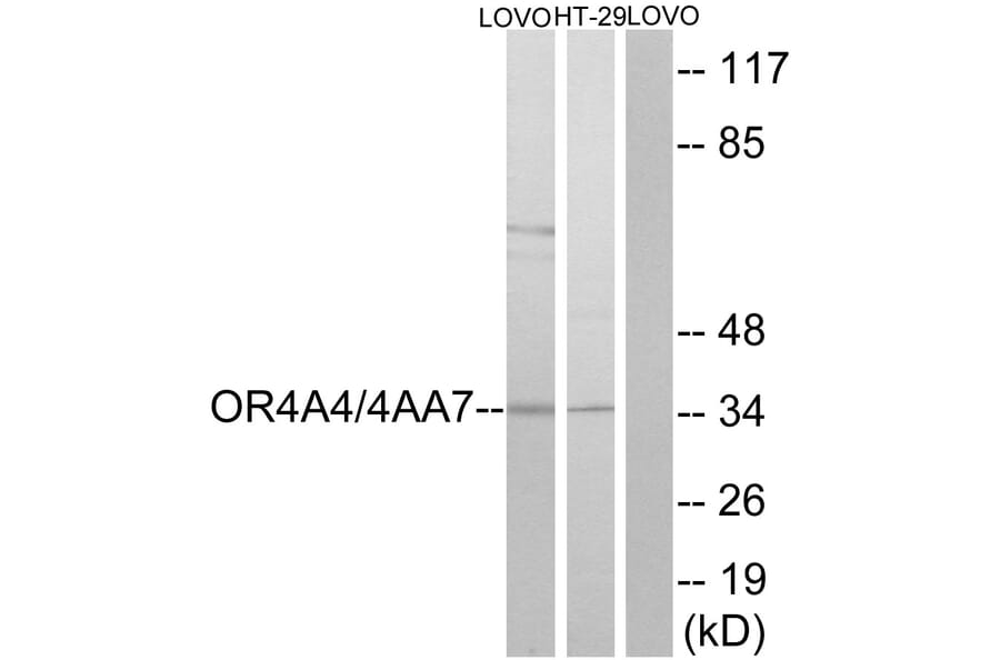Western Blot - Anti-OR4A4 + OR4A47 Antibody (G581) - Antibodies.com