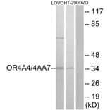 Western Blot - Anti-OR4A4 + OR4A47 Antibody (G581) - Antibodies.com