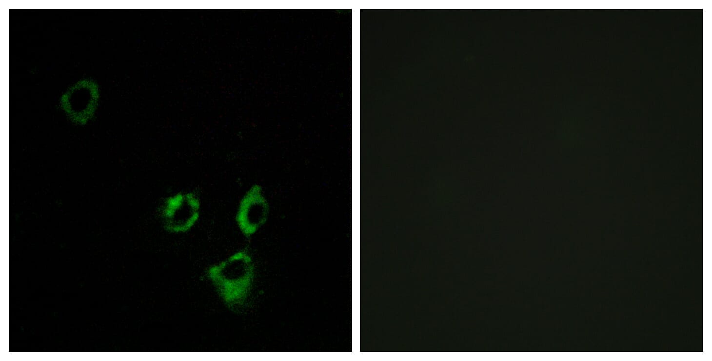 Immunofluorescence analysis of MCF7 cells using Anti-OR2T5 + OR2T29 Antibody. The right hand panel represents a negative control, where the antibody was pre-incubated with the immunising peptide.
