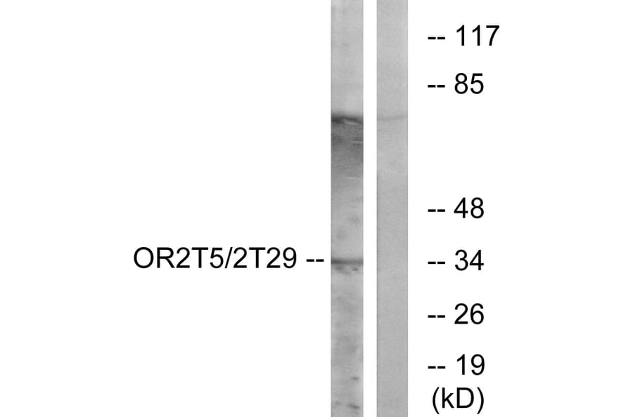 Western Blot - Anti-OR2T5 + OR2T29 Antibody (G842) - Antibodies.com