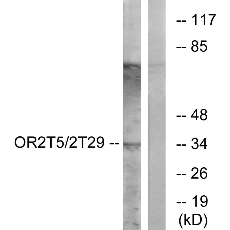 Western Blot - Anti-OR2T5 + OR2T29 Antibody (G842) - Antibodies.com