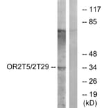 Western Blot - Anti-OR2T5 + OR2T29 Antibody (G842) - Antibodies.com