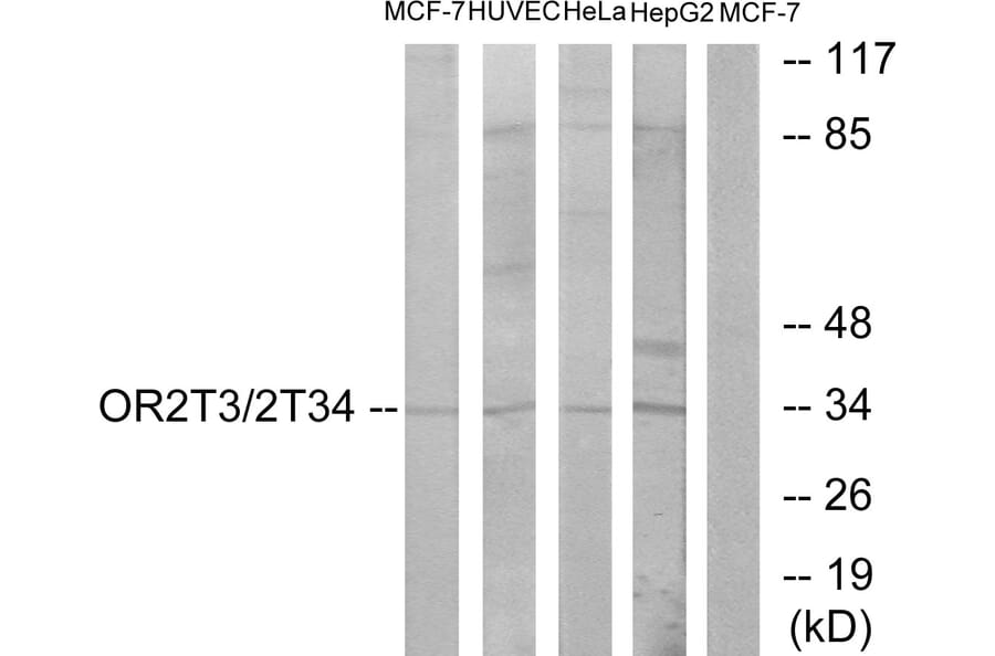 Western Blot - Anti-OR2T3 + OR2T34 Antibody (G568) - Antibodies.com